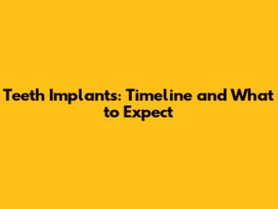 Teeth Implants: Timeline and What to Expect